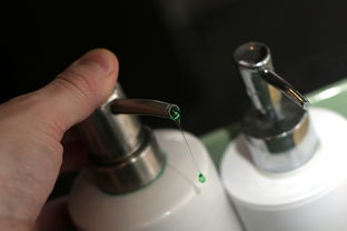 宫腔粘连导致胎停怎么分离防再粘
